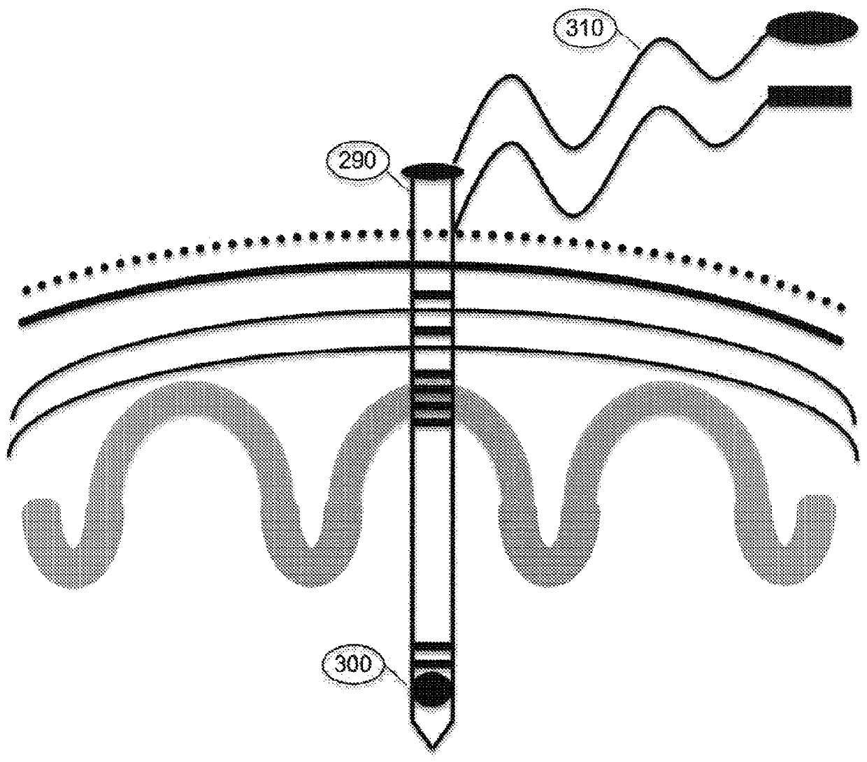 Systems and methods for positioning an intracranial device using brain activity