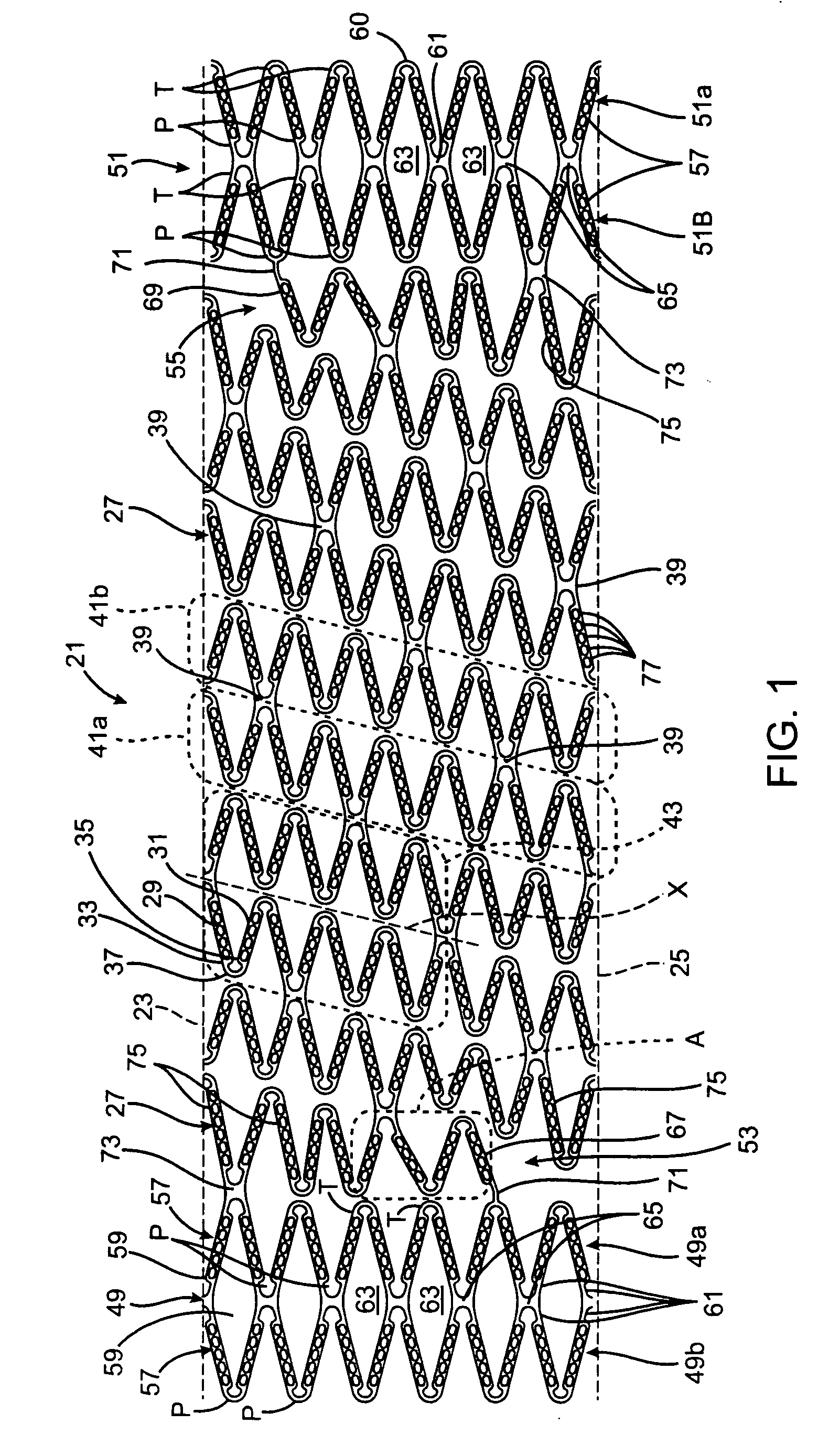 Stent with flexible hinges