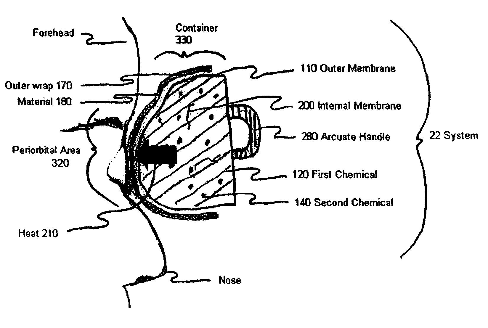 Device and method for exothermic treatment of eyelid diseases