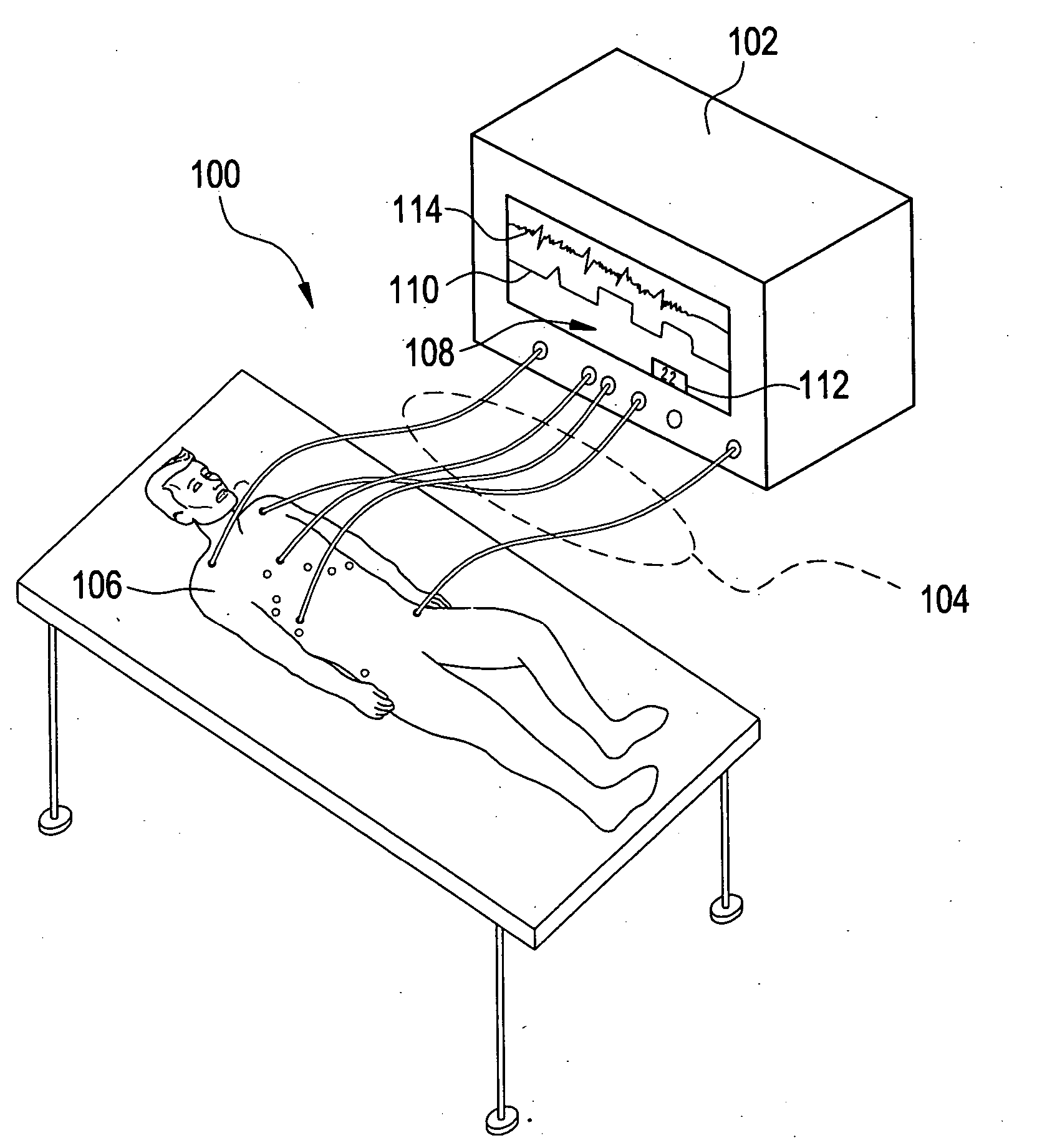 Respiration monitoring system and method