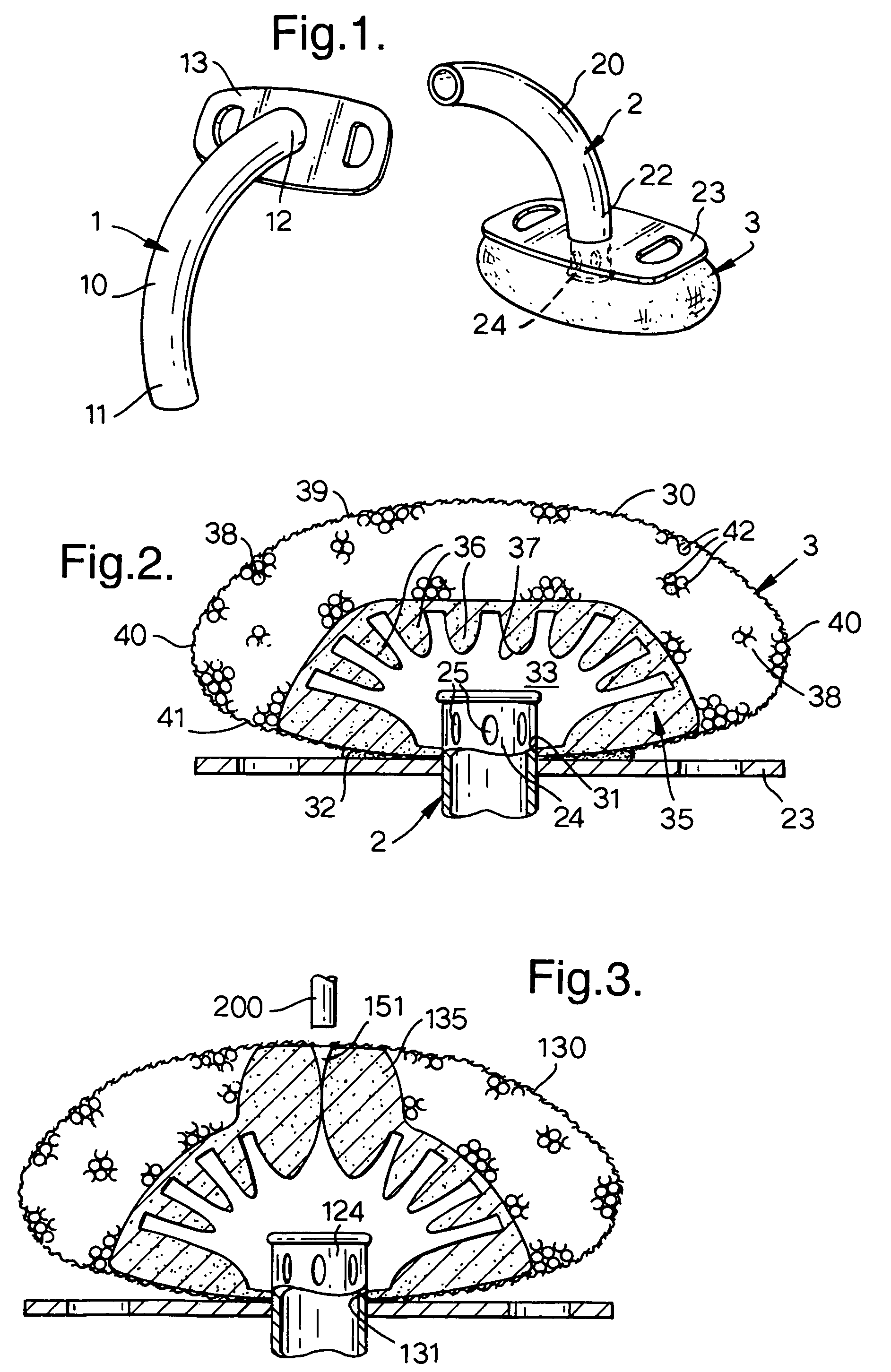 Gas-treatment devices