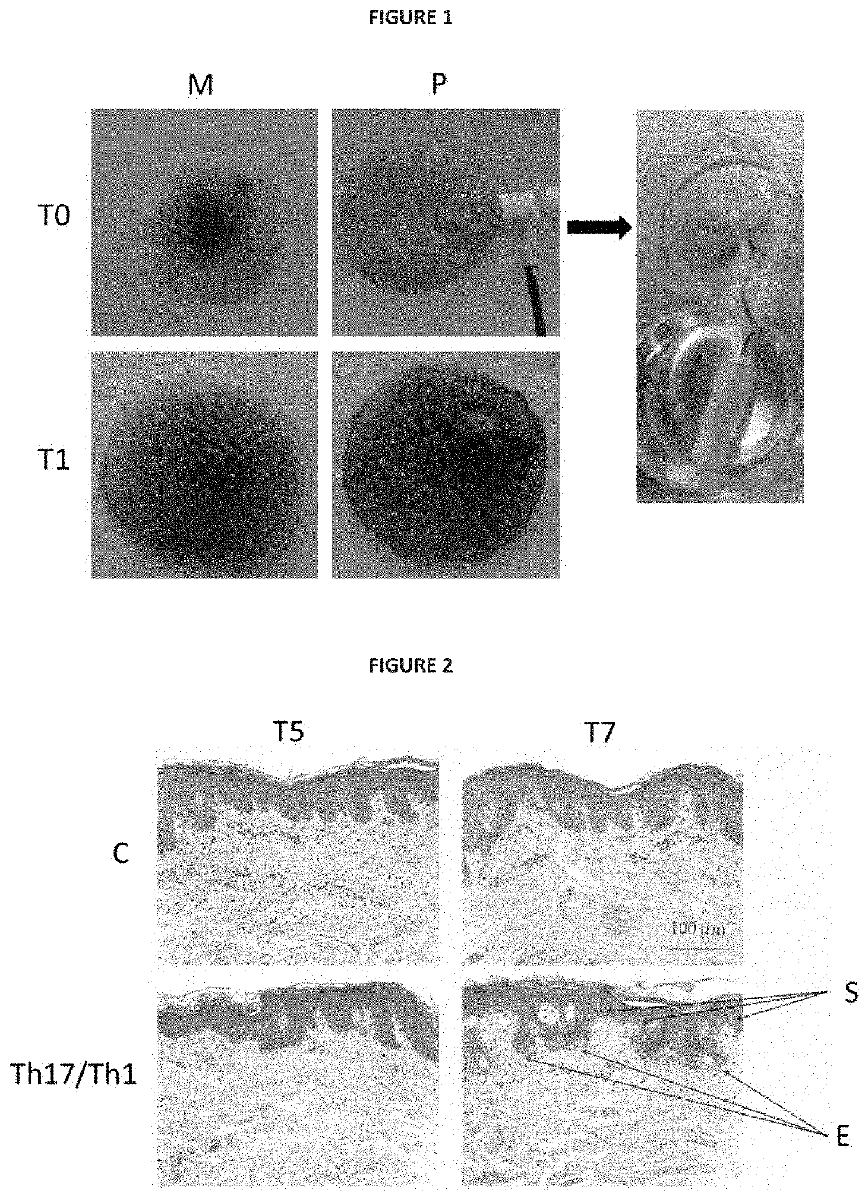 Ex vivo model of inflamed human skin and uses thereof for screening Anti-inflammatory compounds