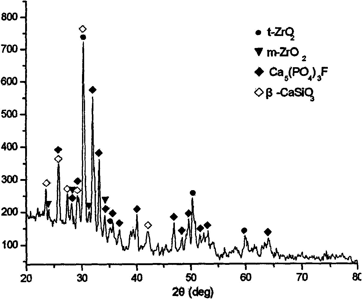 ZrO2 toughened bioactive glass-ceramics of MgO-CaO-SiO2-P2O5-CaF2 system and preparation method thereof