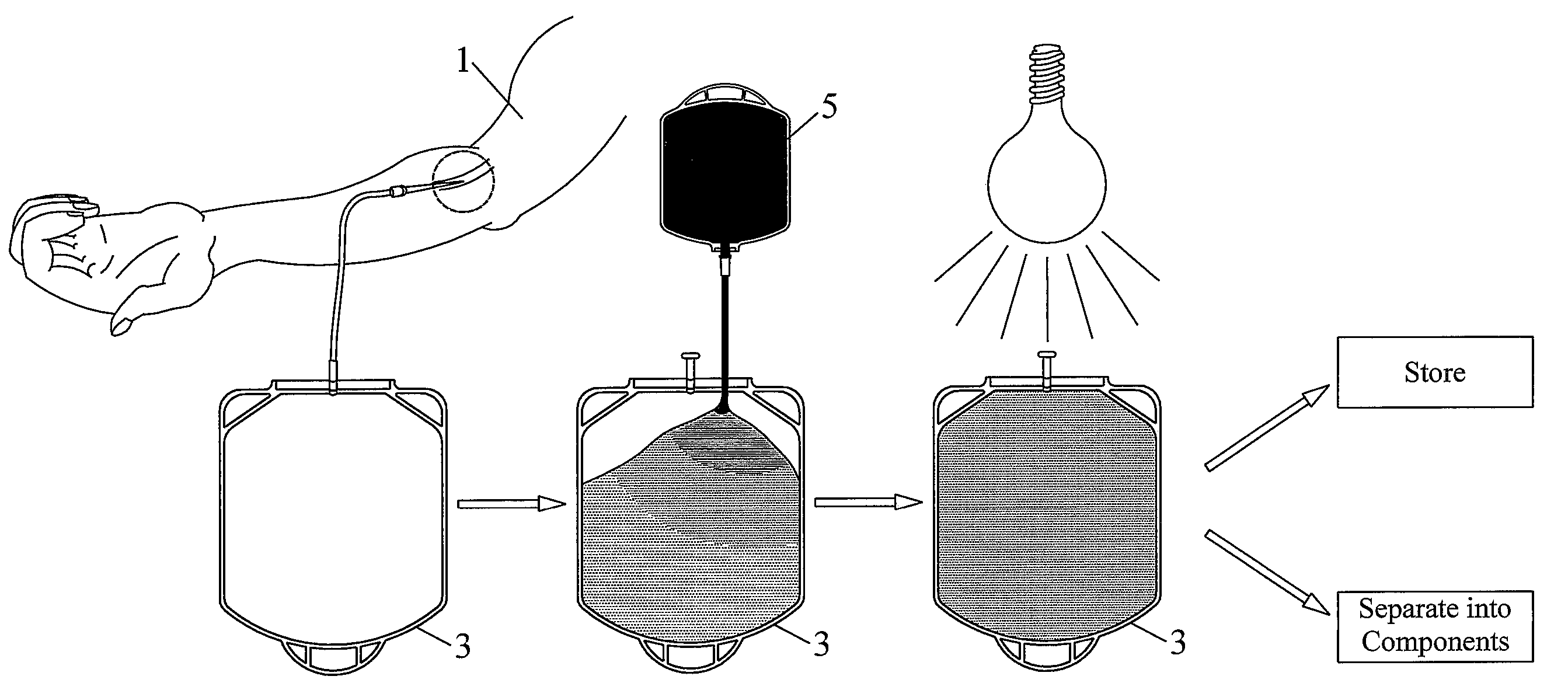 Pathogen Inactivation of Whole Blood