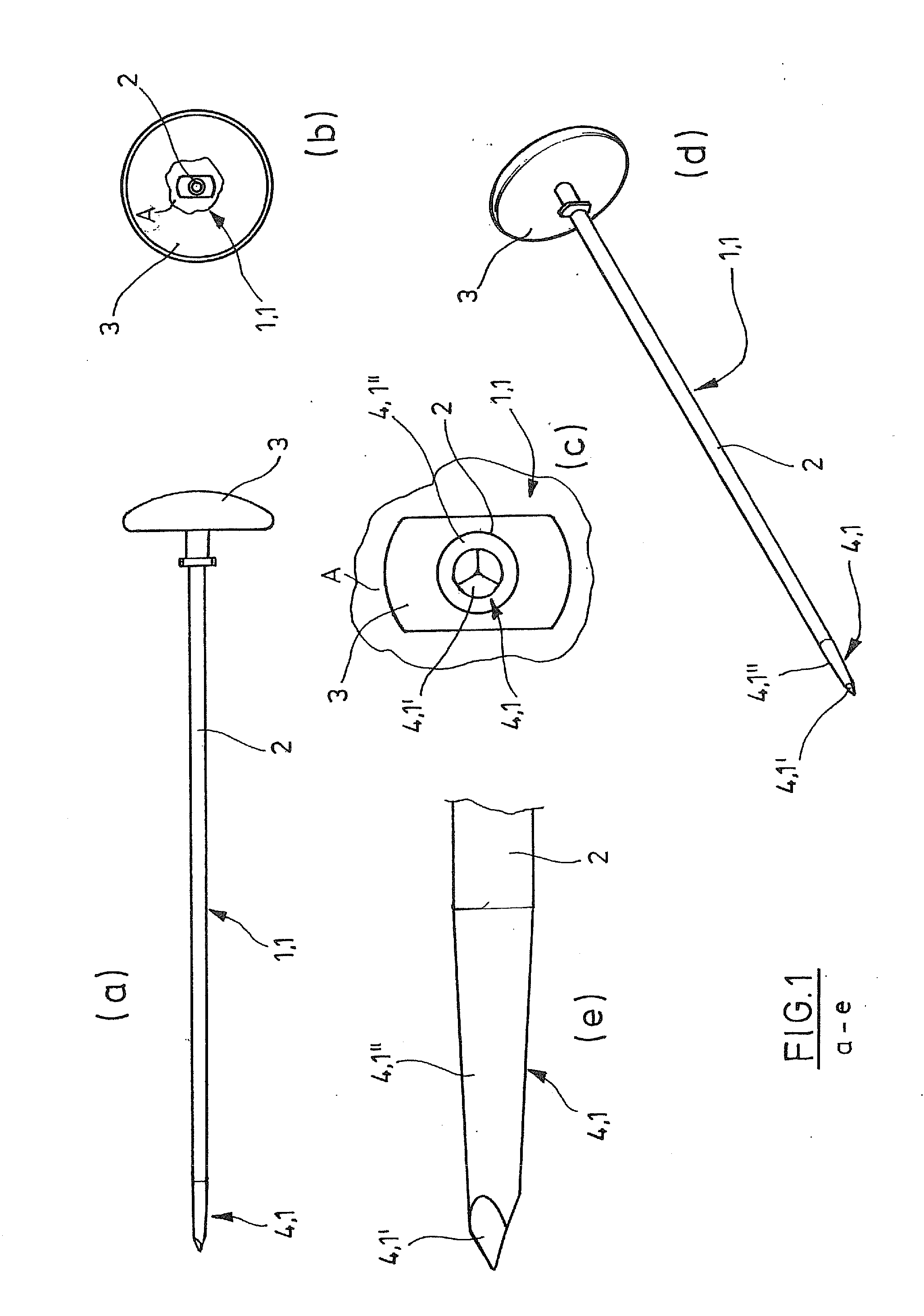 Kit for Providing an Artificial Stomach Entrance