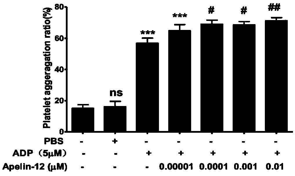 Pharmaceutical composition containing Apelin-12 and application of pharmaceutical composition