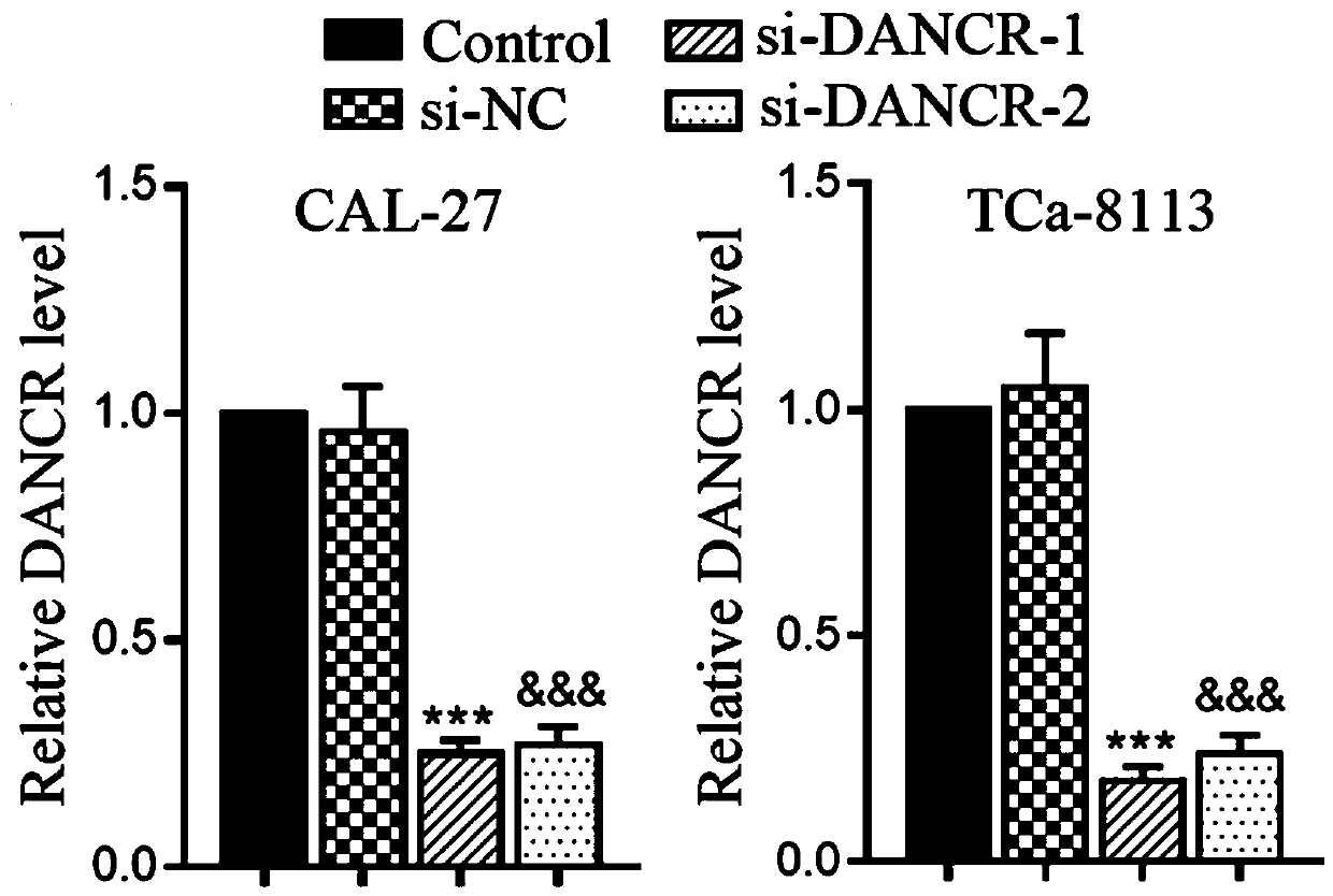 Molecular marker for preventing, diagnosing and treating tongue squamous cell carcinoma, and application thereof