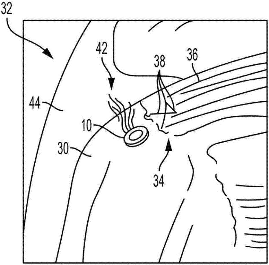 Methods, devices, and systems for blood flow