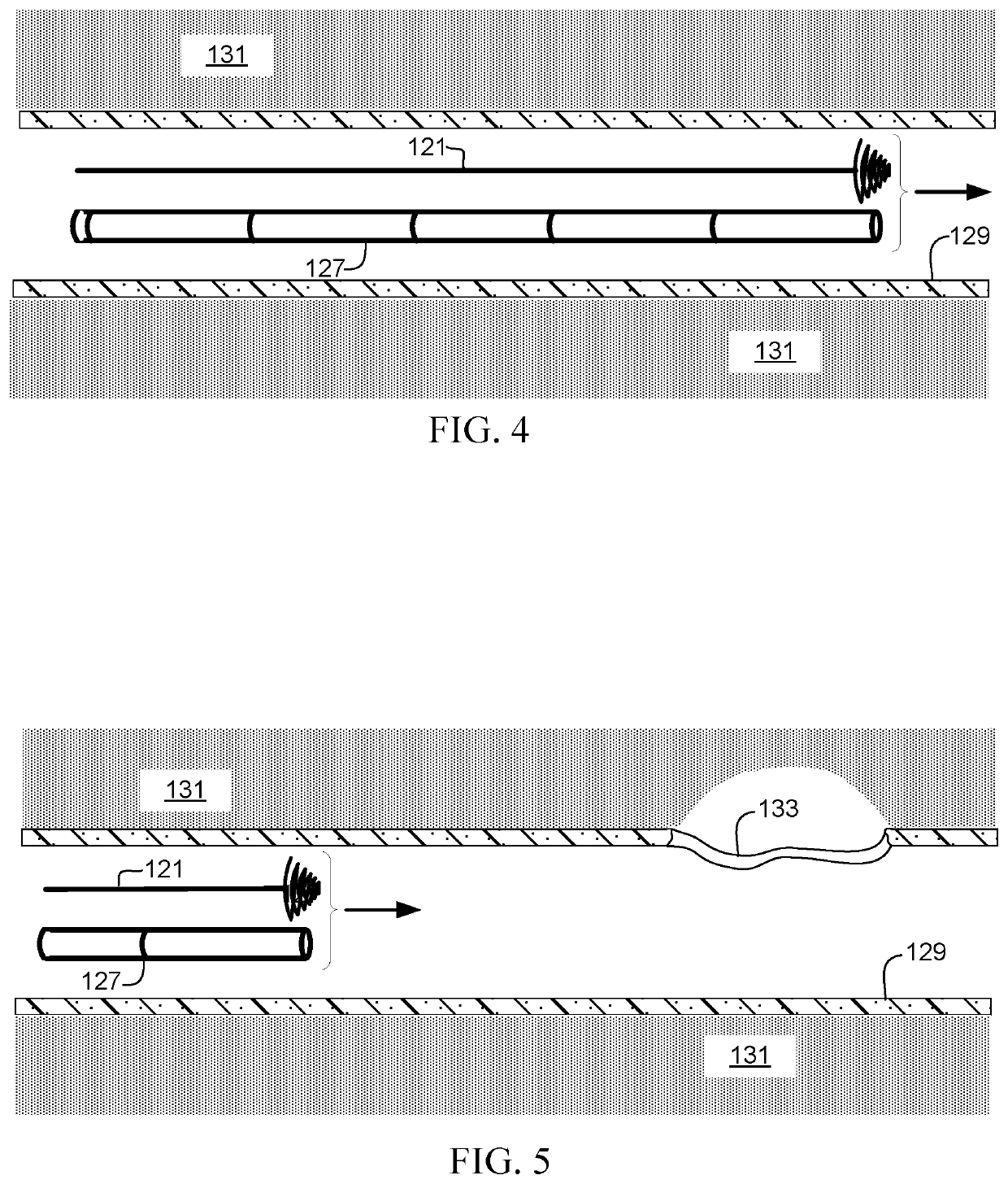 Negative pressure therapy unit and method