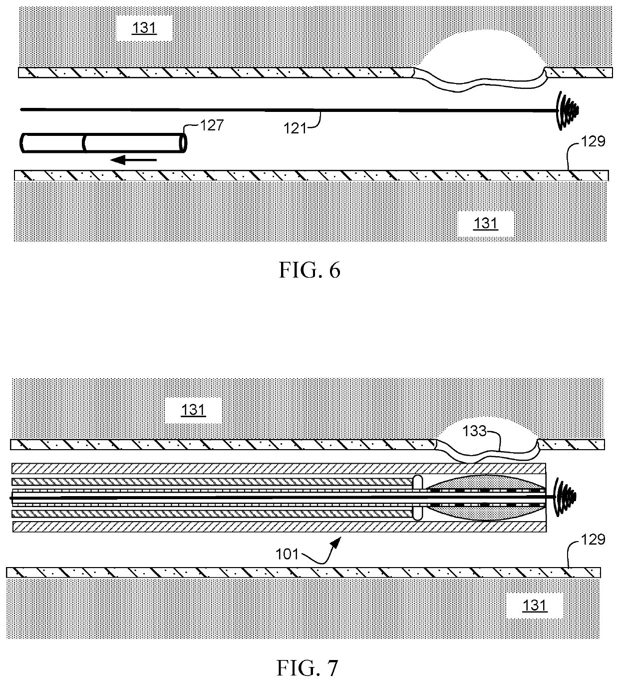 Negative pressure therapy unit and method