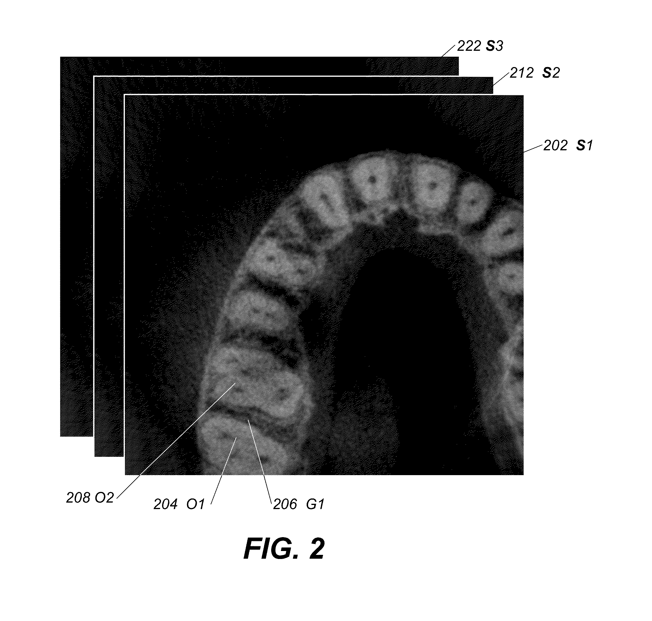 Method and system for tooth segmentation in dental images