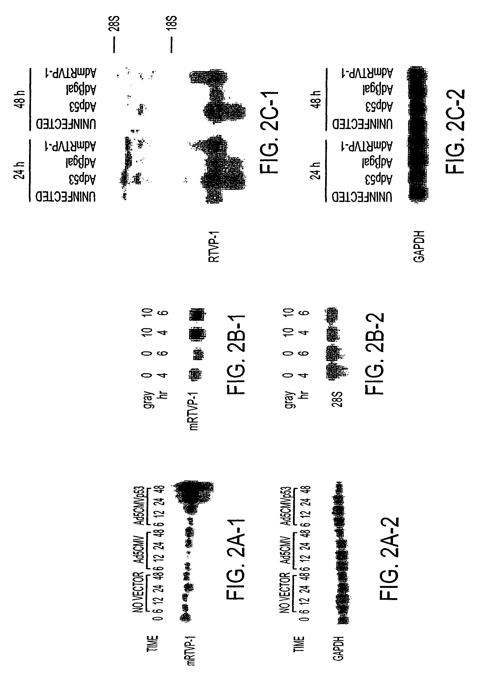 RTVP based compositions and methods for the treatment of prostate cancer