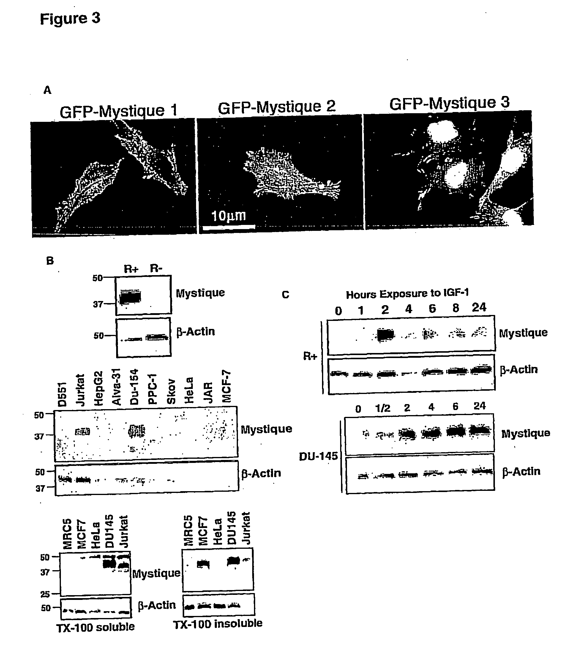 IGF-I responsive gene and use thereof