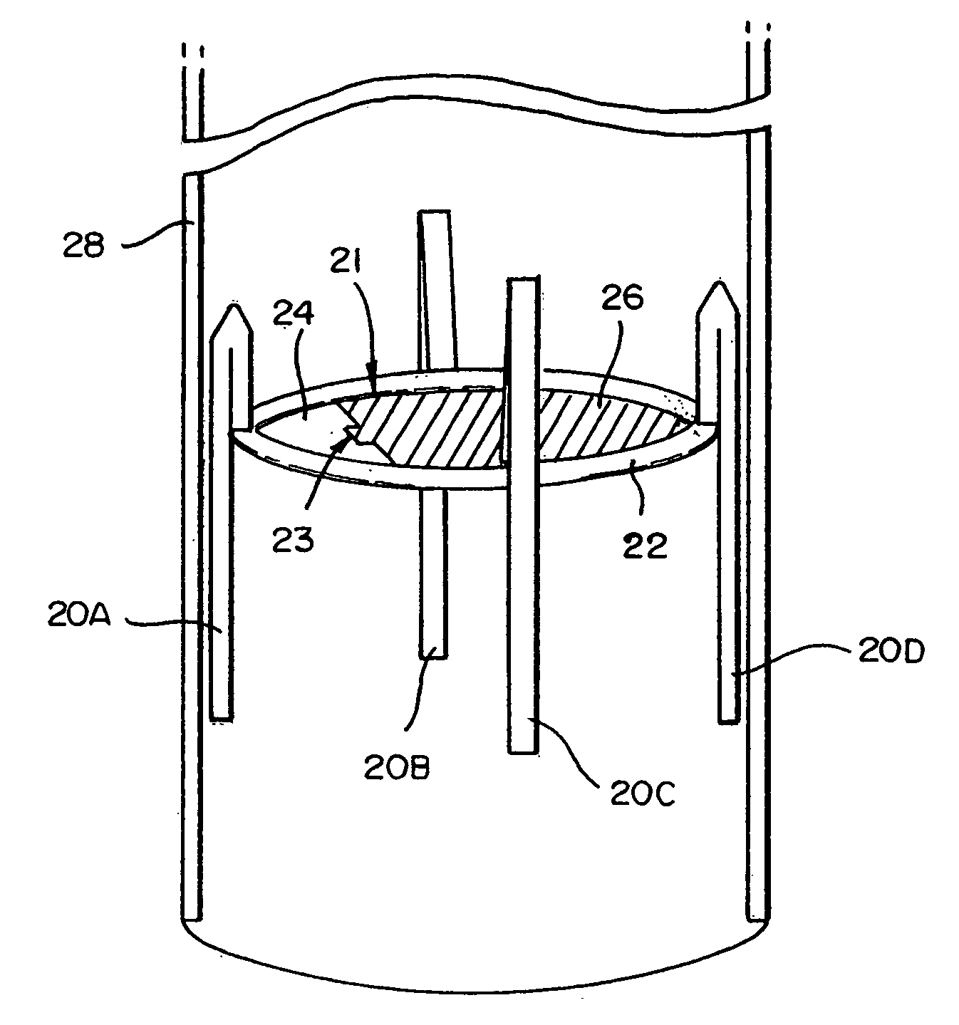 Methods and devices for improving breathing in patients with pulmonary disease