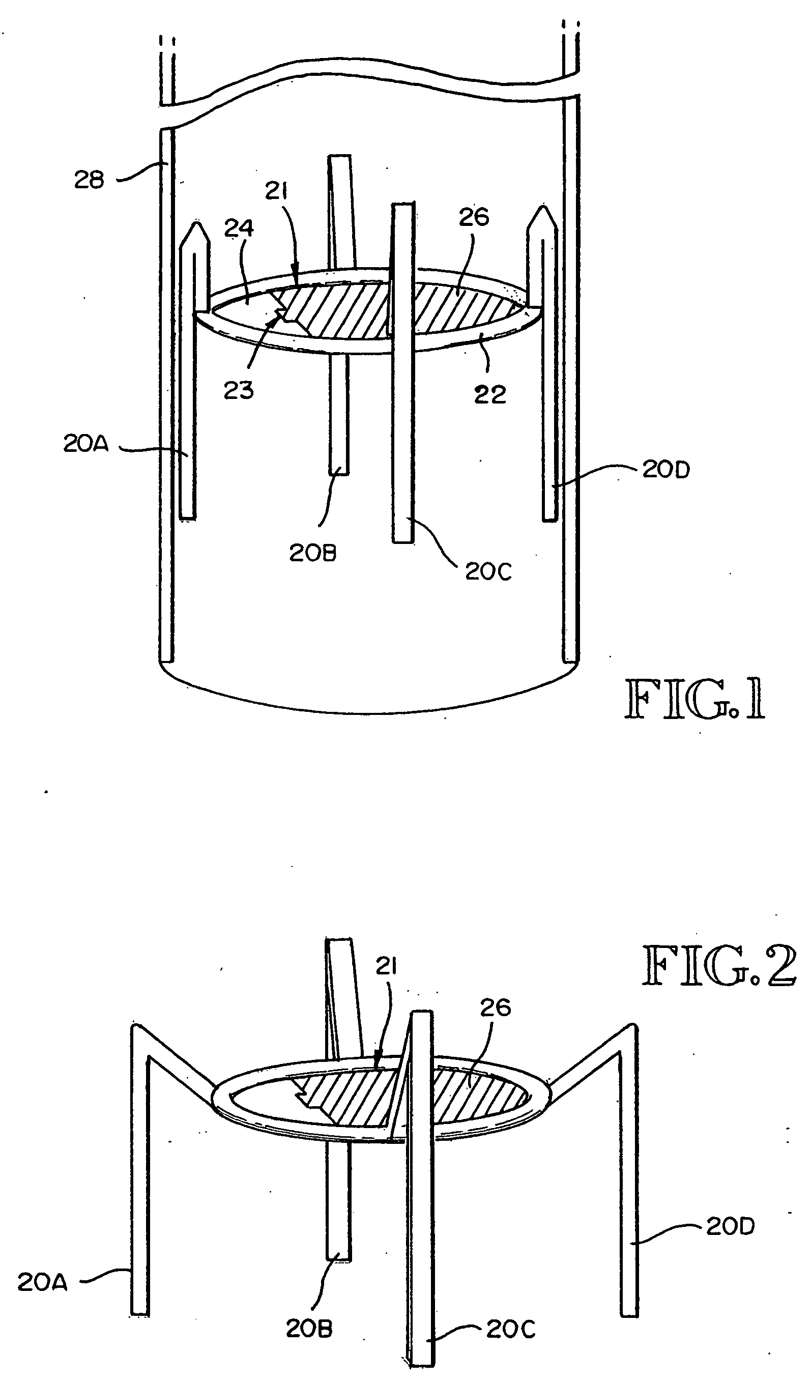 Methods and devices for improving breathing in patients with pulmonary disease