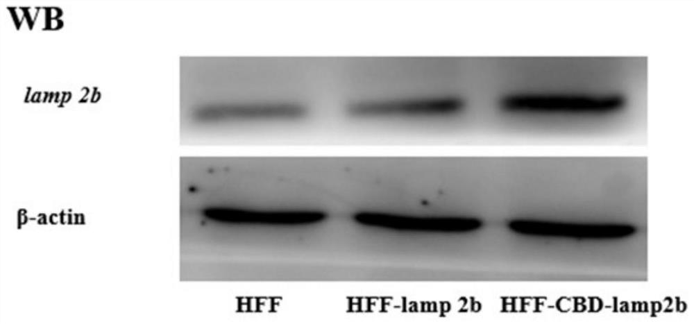 Enrichment method of exosome in extracellular matrix, ECM biological material rich in exosome and application