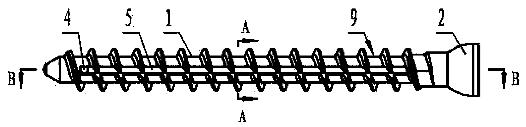 Improved pourable pedicle screw