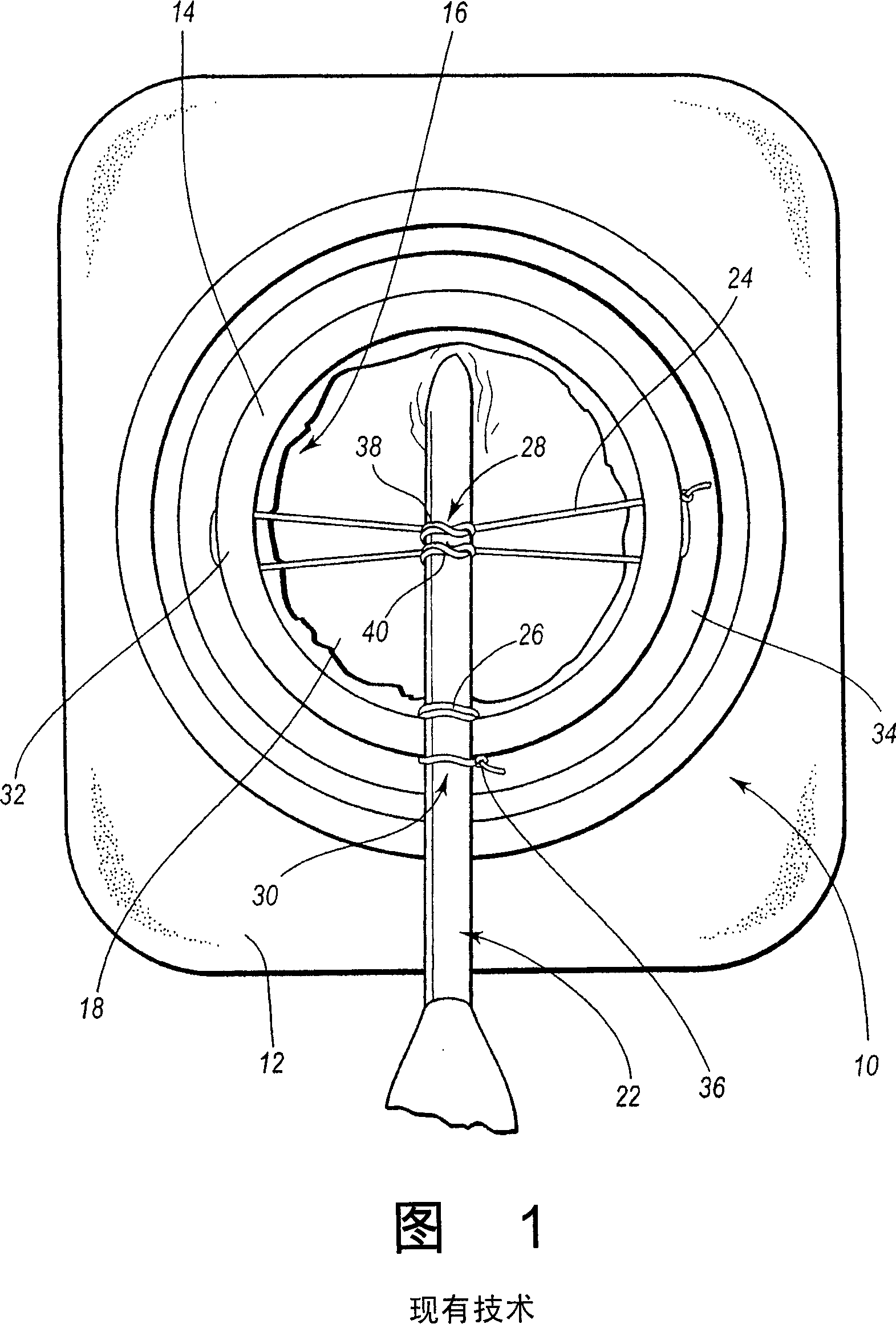 Self-suturing anchor device for a catheter