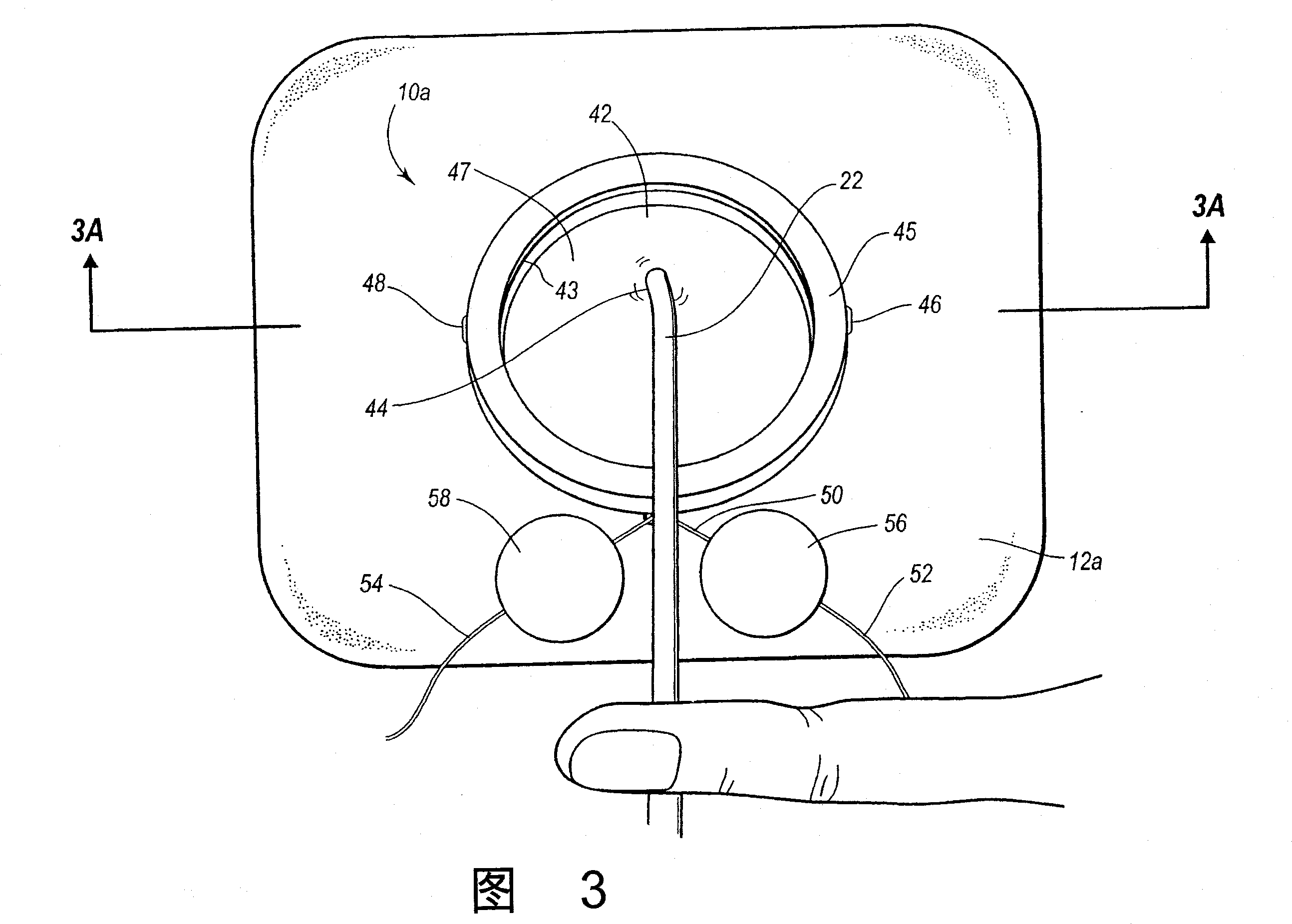 Self-suturing anchor device for a catheter