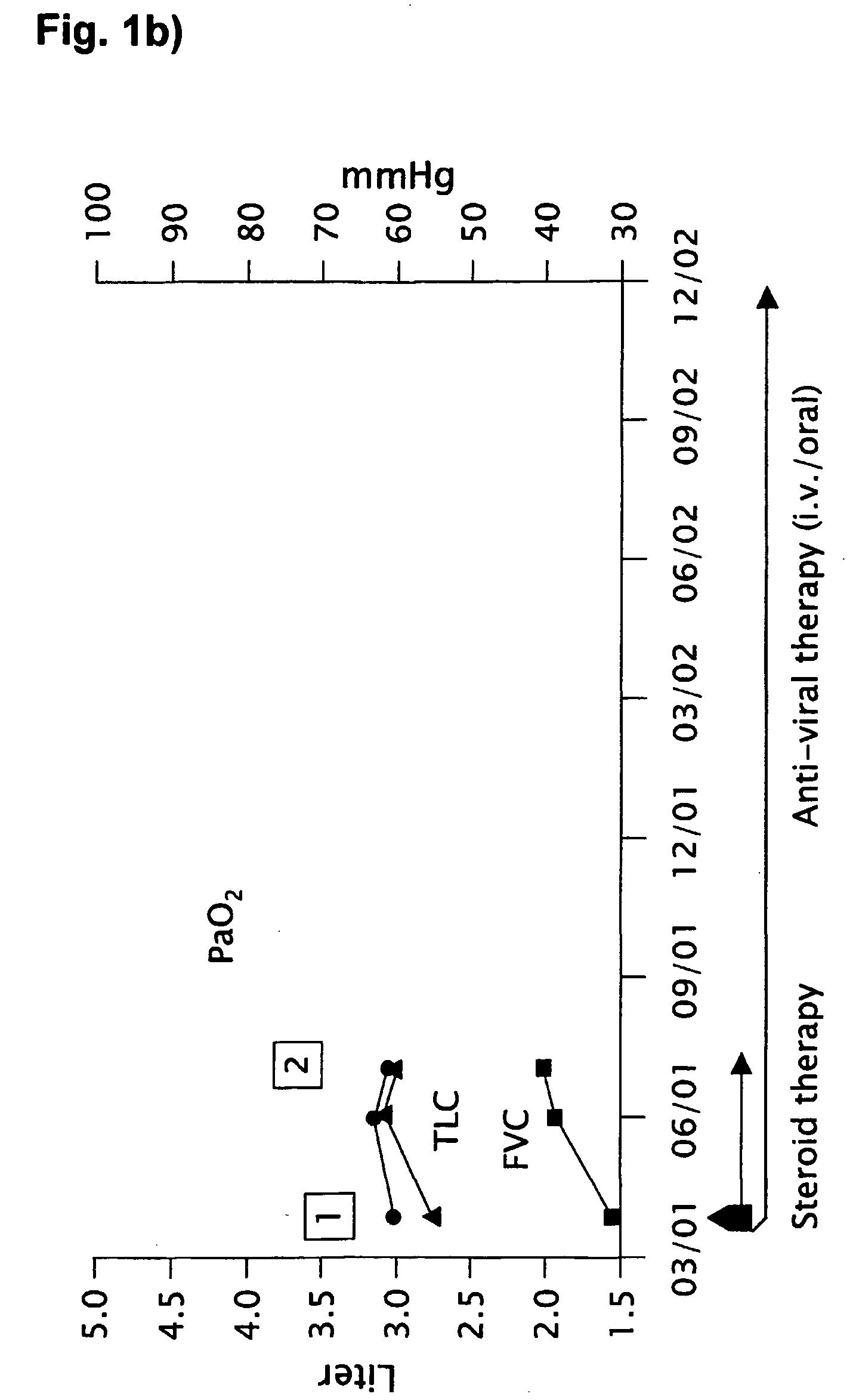 Novel pharmaceutical composition of interferon gamma or pirfenidone with molecular diagnostics for the improved treatment of interstitial lung diseases