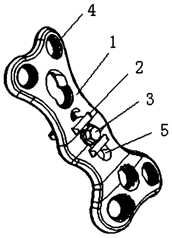 An adjustable bone plate for restoring the line of force of lower limbs after tibial osteotomy