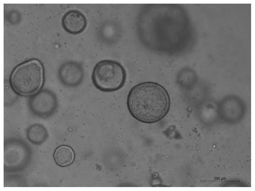 Three-dimensional culture method for in-vitro endometrial gland organs