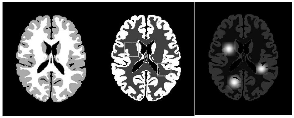 Positron emission tomography simulation method and system based on numerical calculation