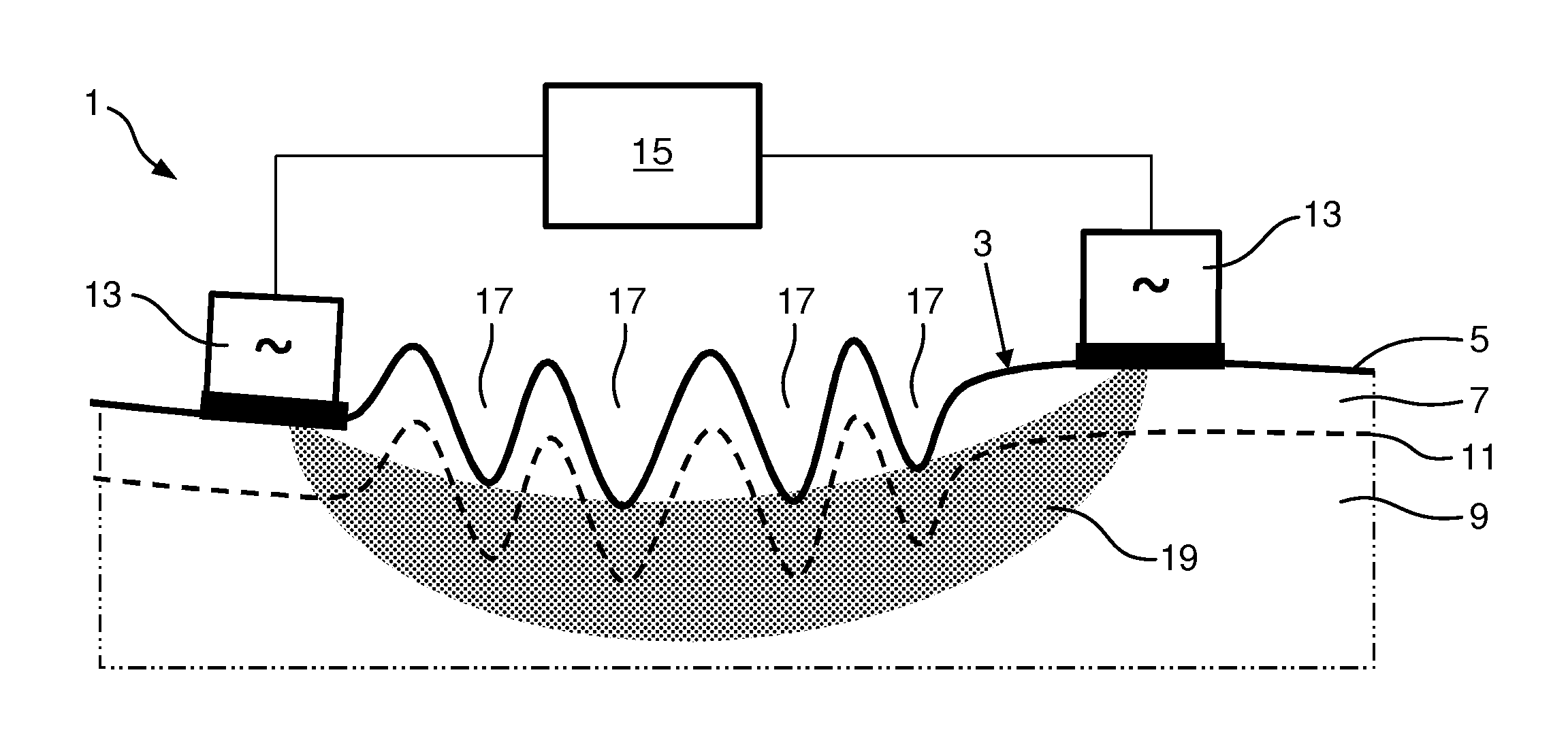 Skin treatment method and apparatus