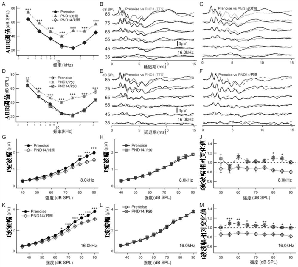 Application of p276-00 in preparation of medicine for preventing and treating noise-induced hearing loss