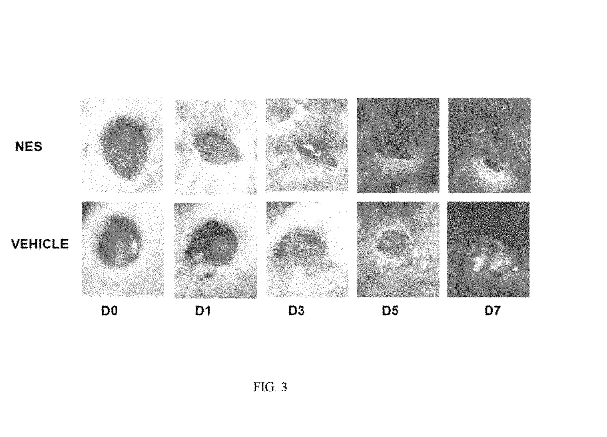 Treatment to promote wound healing