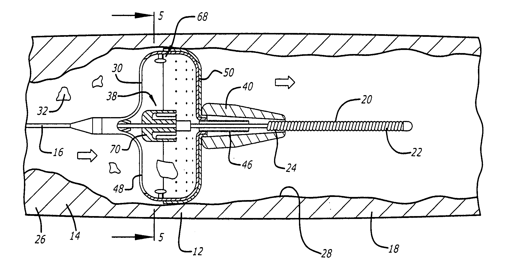 Sheathless embolic protection system