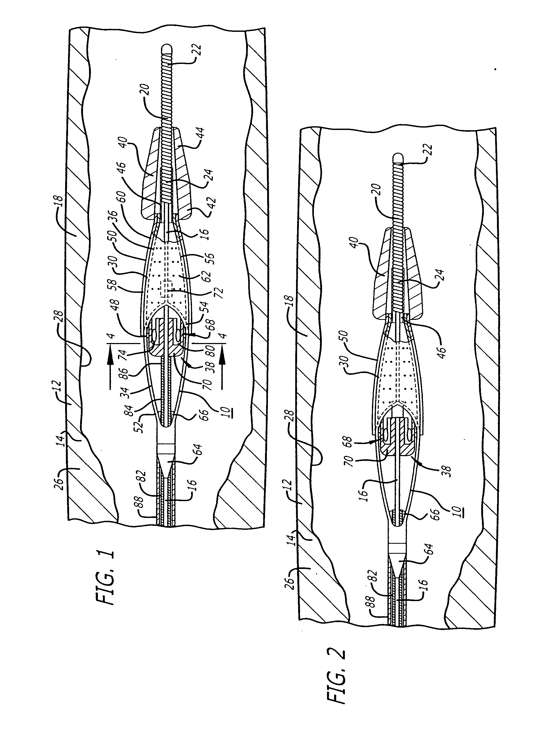 Sheathless embolic protection system