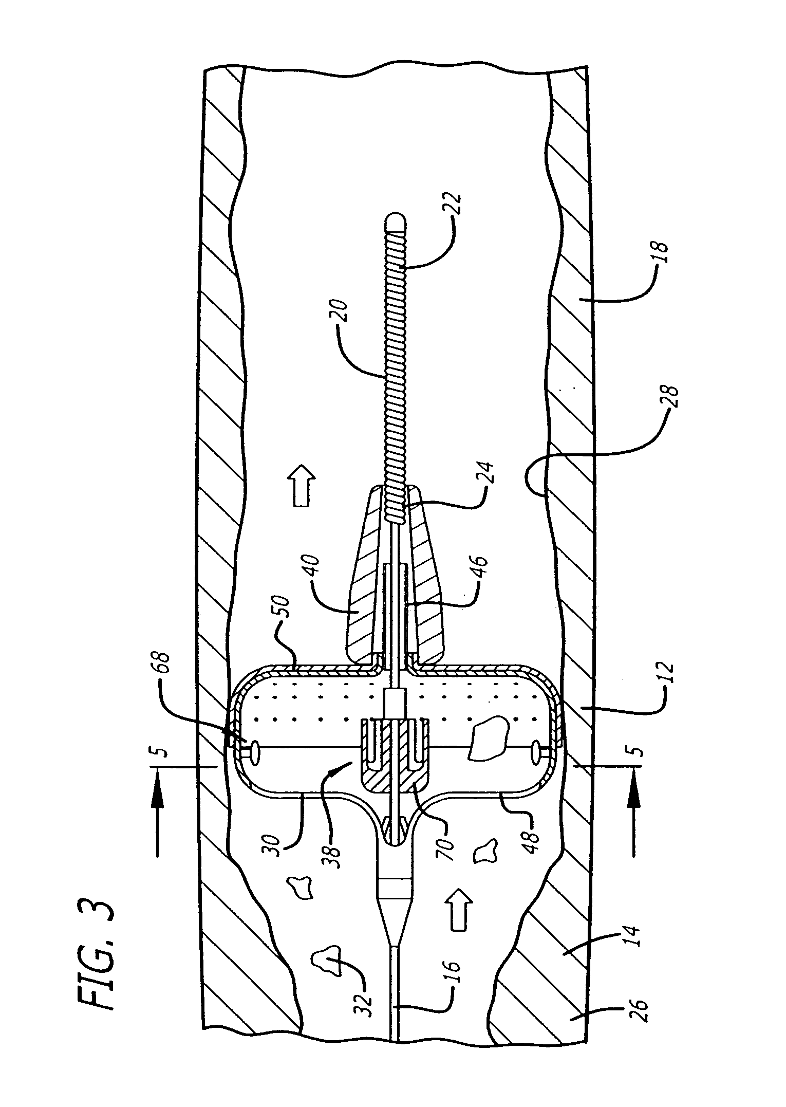 Sheathless embolic protection system