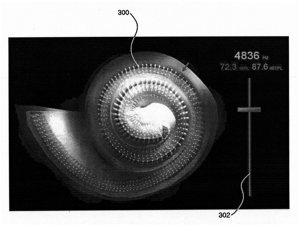 Methods and devices for stimulating hair cells using acoustic signals