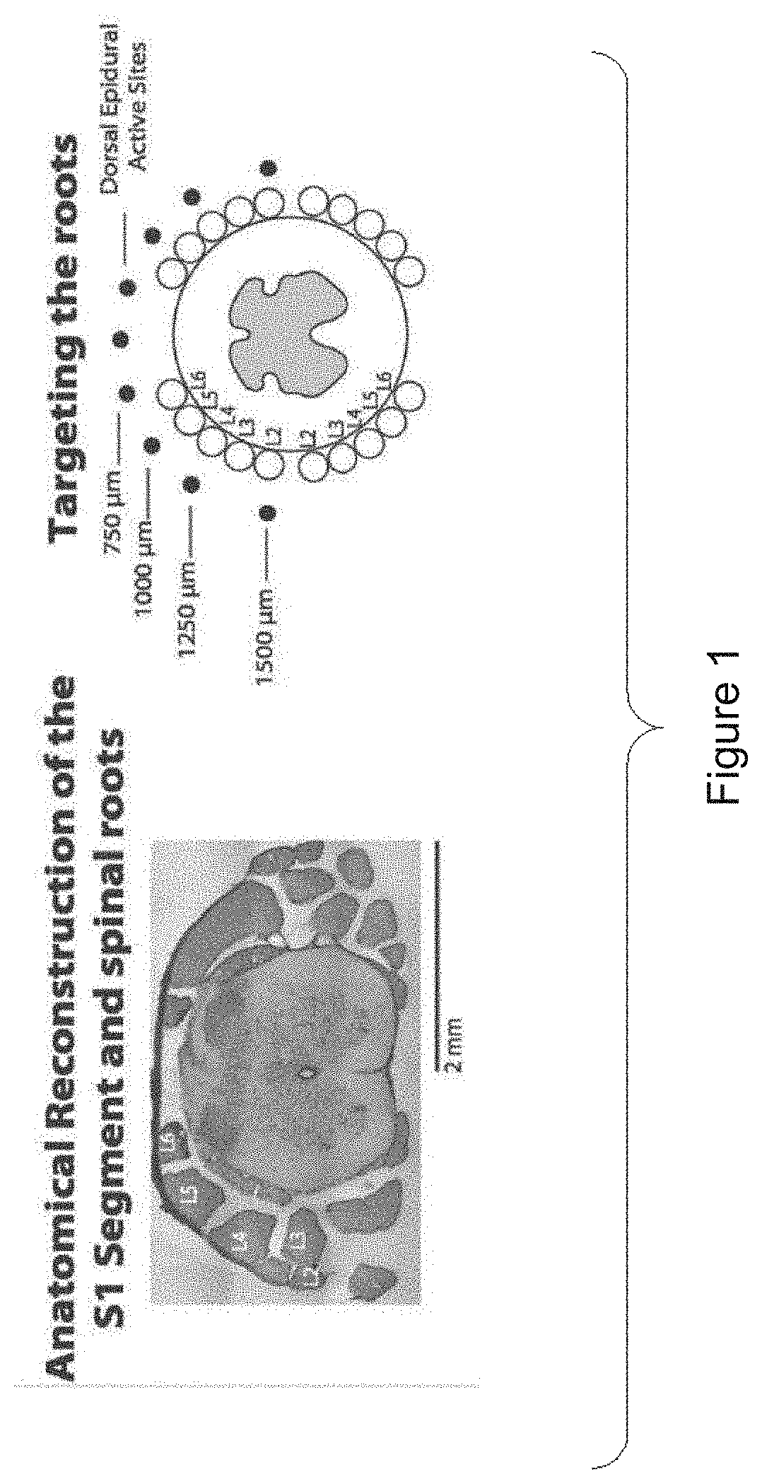 System for selective spatiotemporal stimulation of the spinal cord