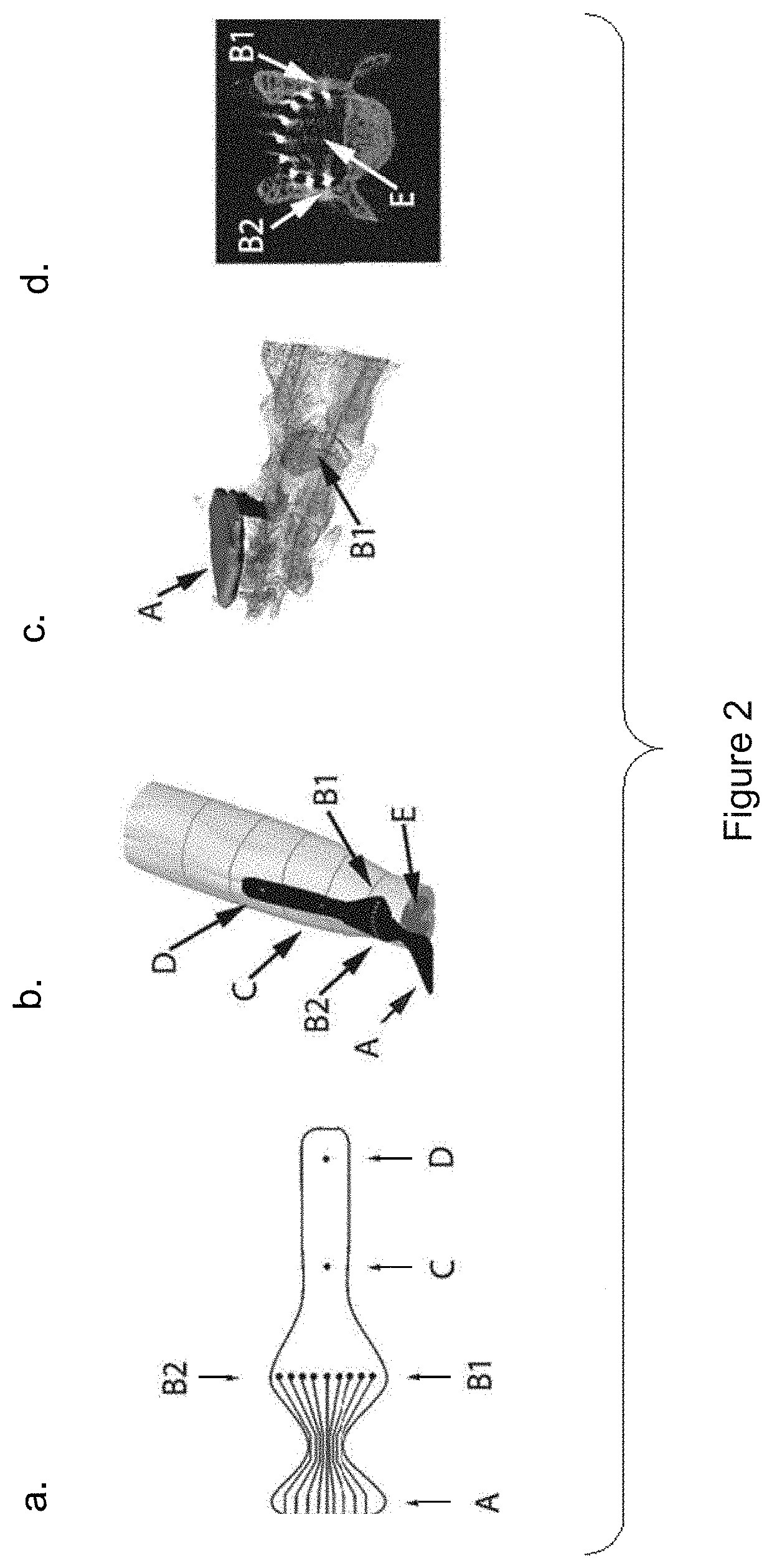 System for selective spatiotemporal stimulation of the spinal cord