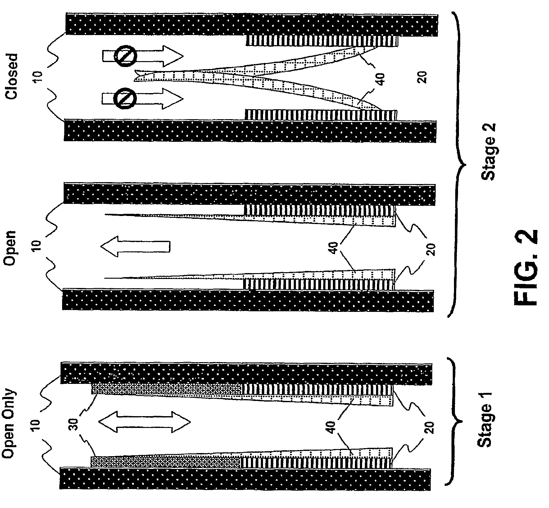 Implantable prosthetic valve