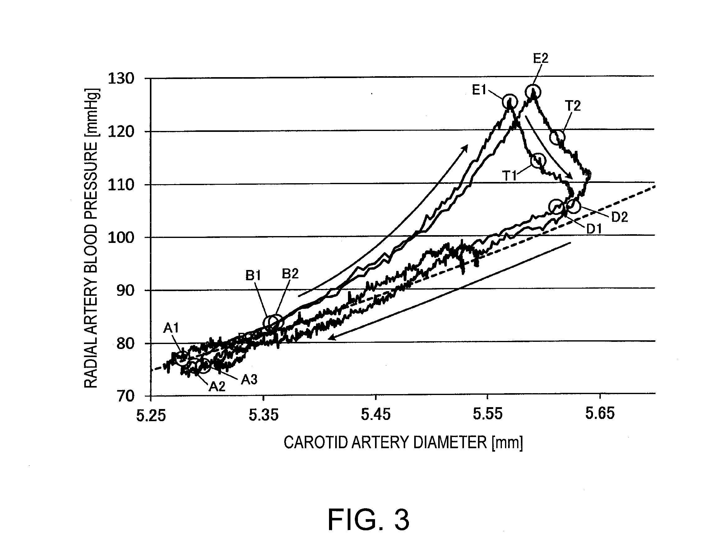 Blood pressure measuring apparatus and method for calibrating central blood pressure estimation parameter