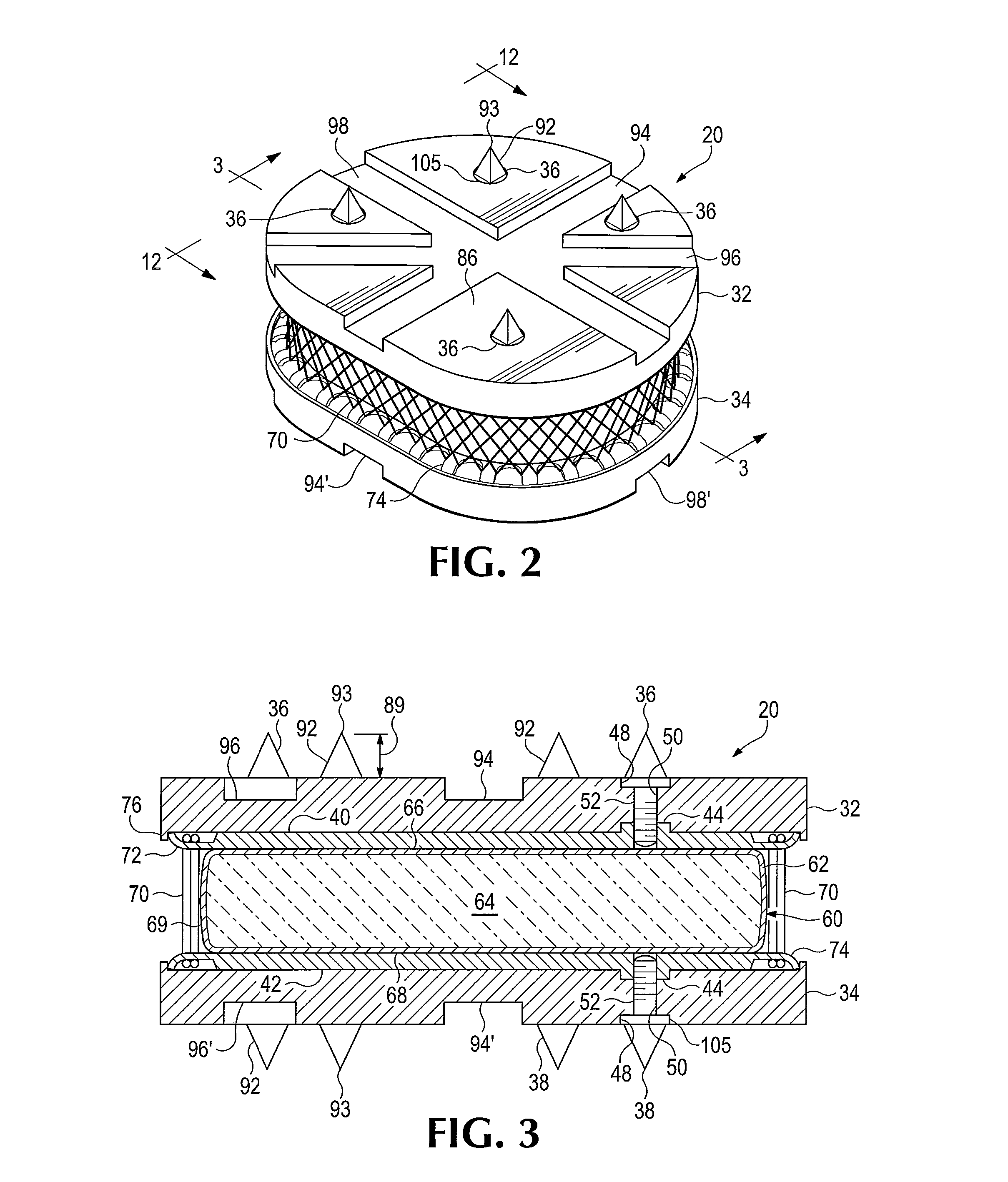 Anatomic total disc replacement