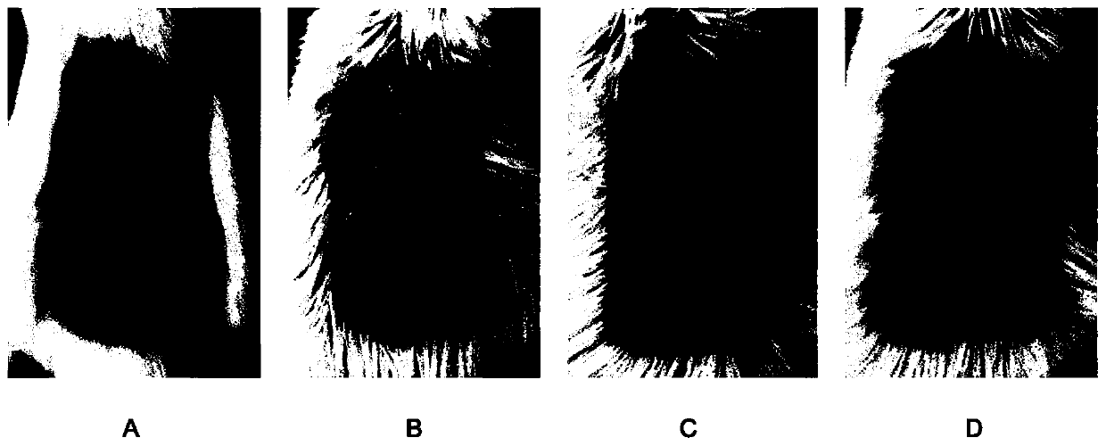 Application of decenotinib in preparation of externally applied medicine for treating psoriasis, medicine and preparation method of medicine