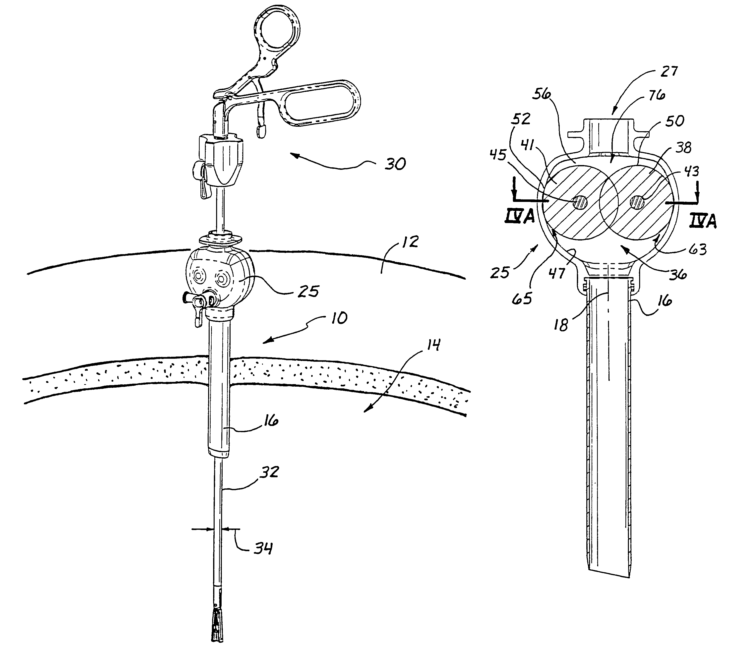 Access sealing apparatus and method