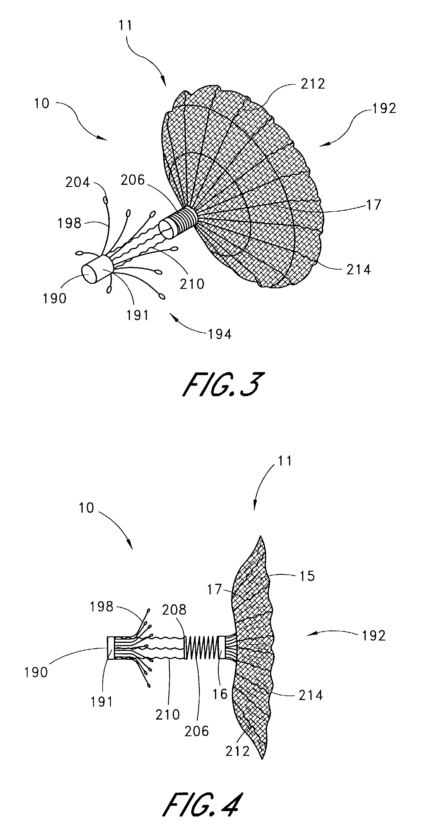 Left atrial appendage occlusion device with active expansion