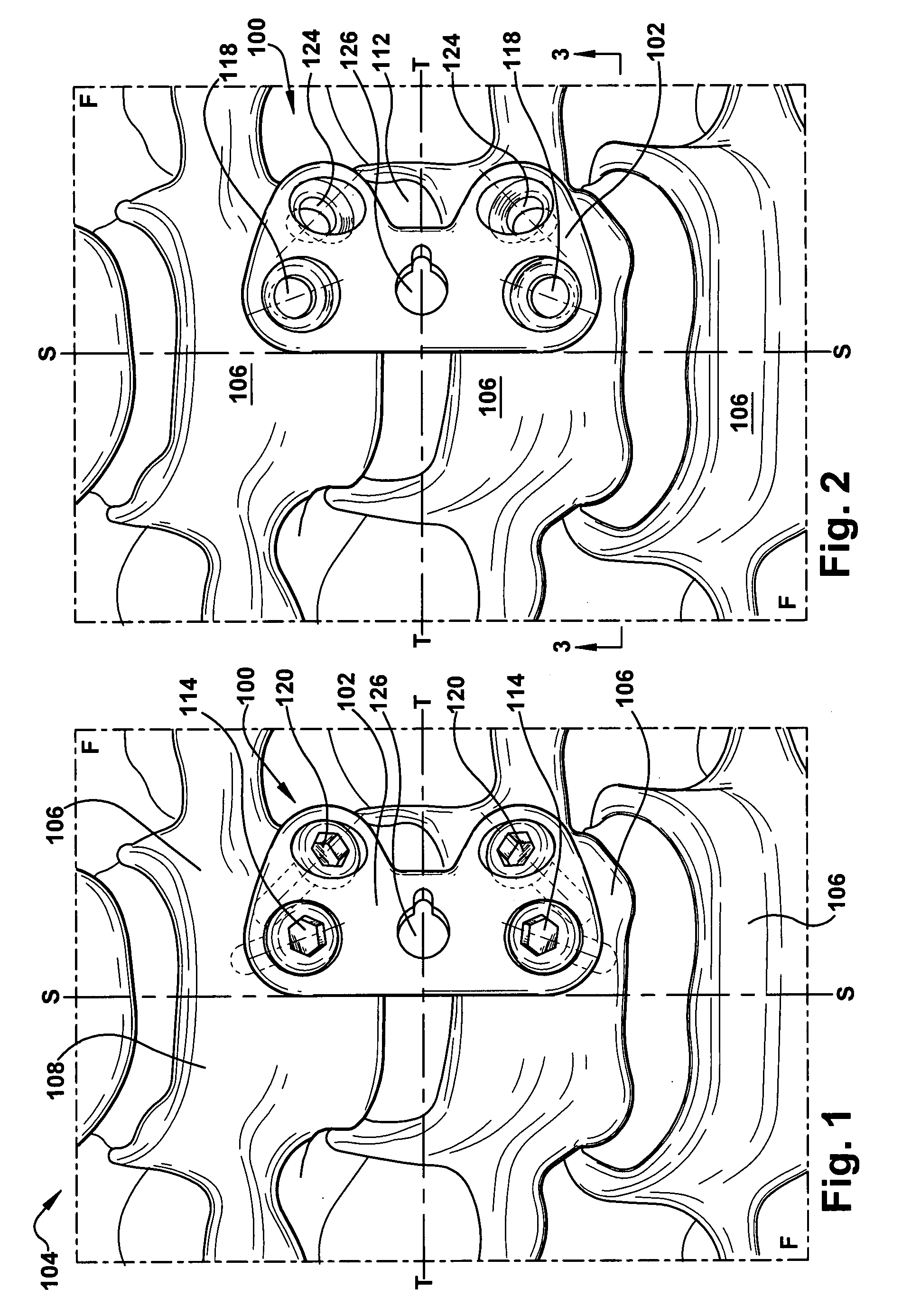 Cervical fusion apparatus and method for use