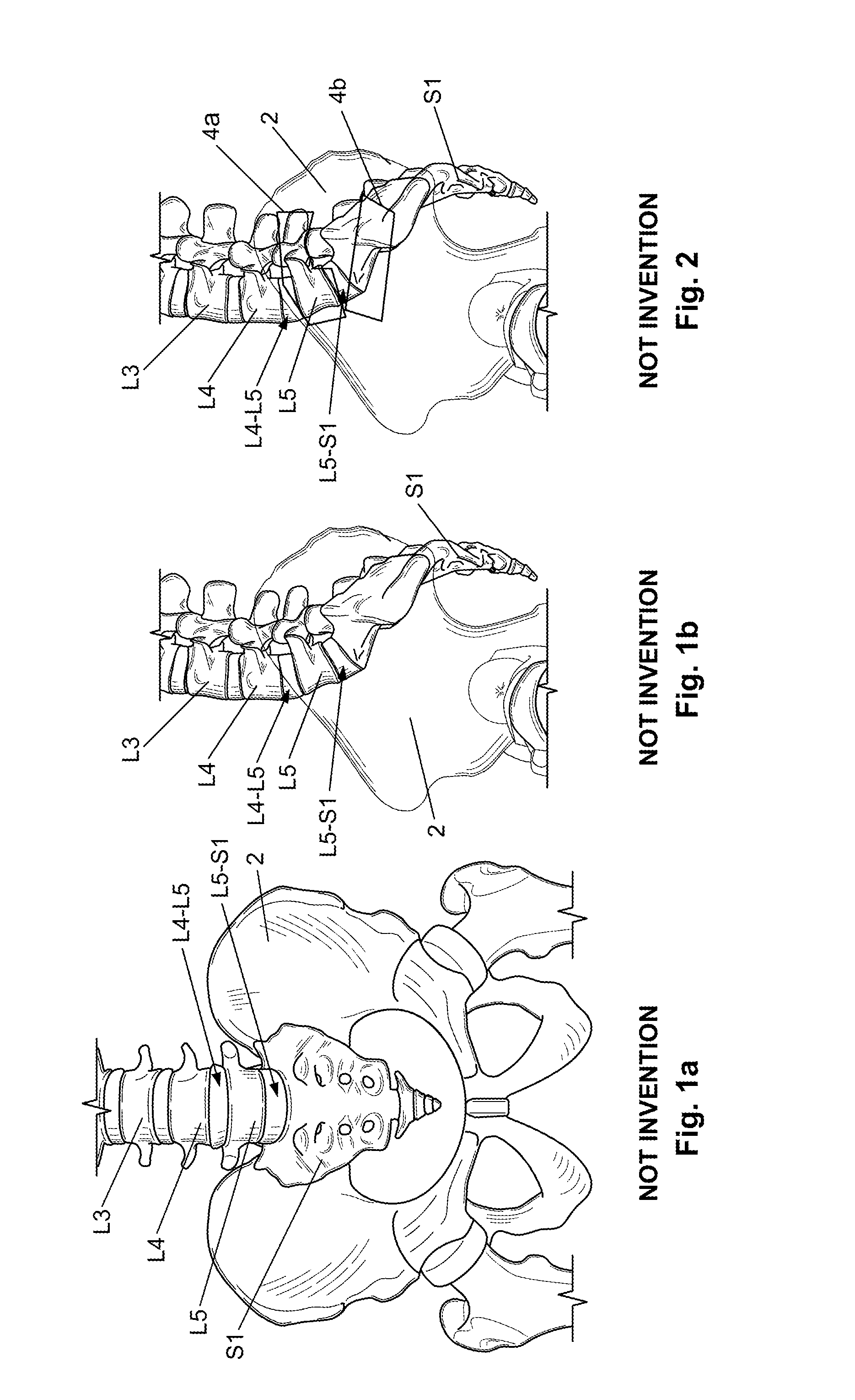 Support device and method of use