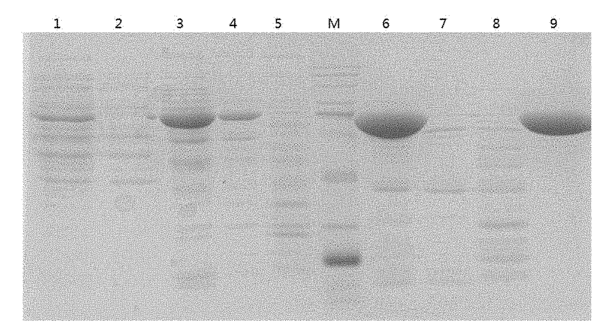 Immunogenic composition for preventing pneumococcal diseases and preparation method thereof