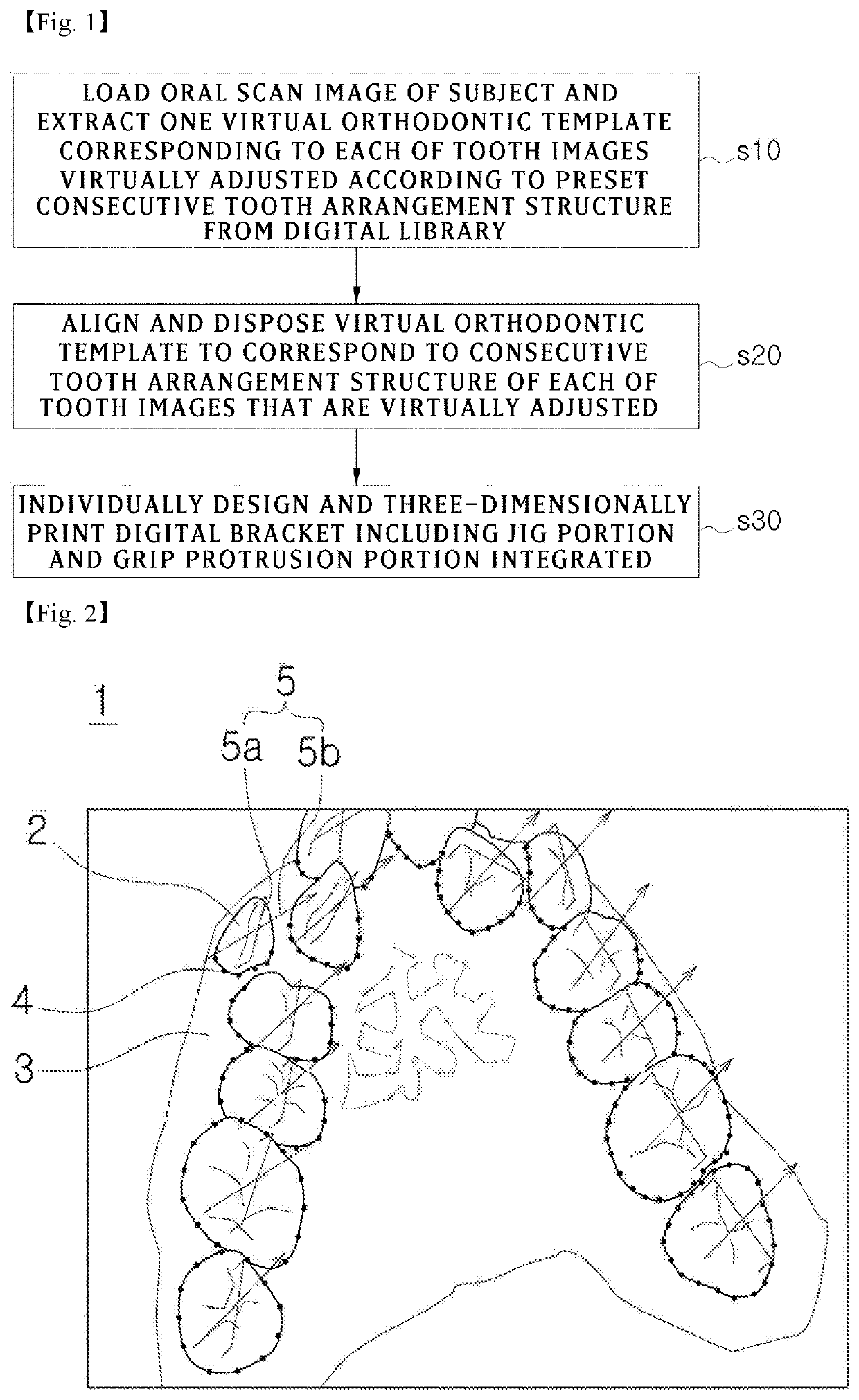 Orthodontic bracket