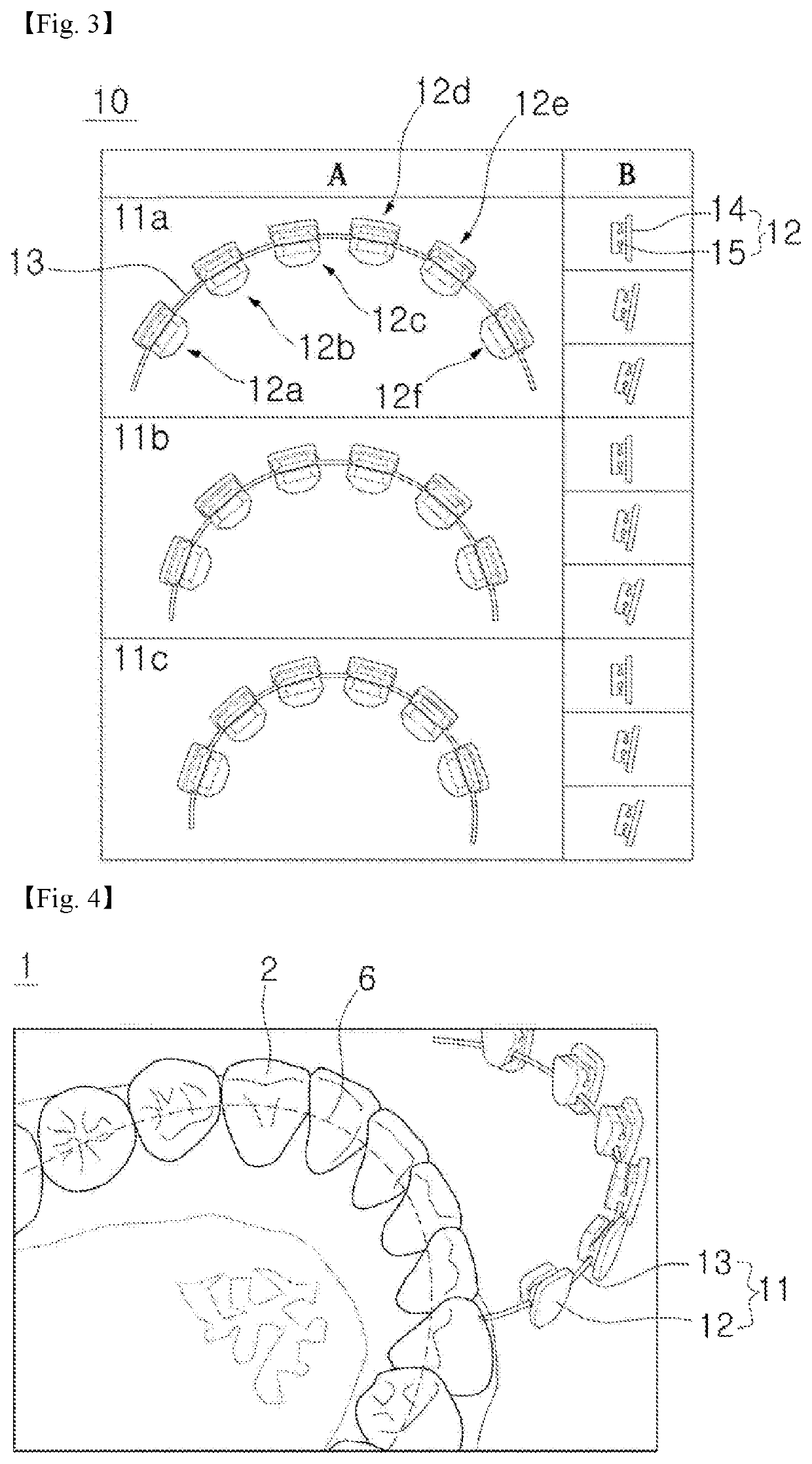 Orthodontic bracket