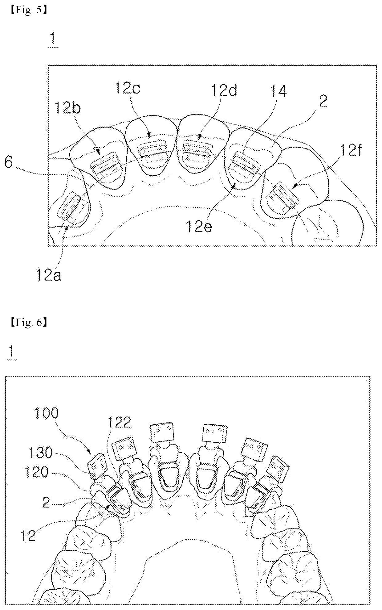 Orthodontic bracket