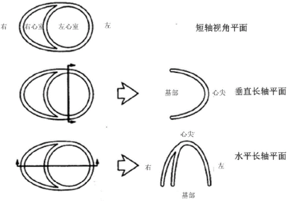 Heart model building method, heart model registration and heart multi-plane reconstruction method