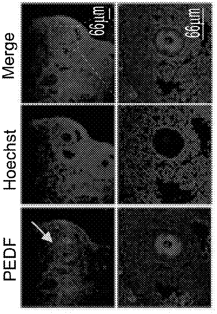 Compositions comprising pedf and uses of same in the treatment and prevention of ovary-related syndromes